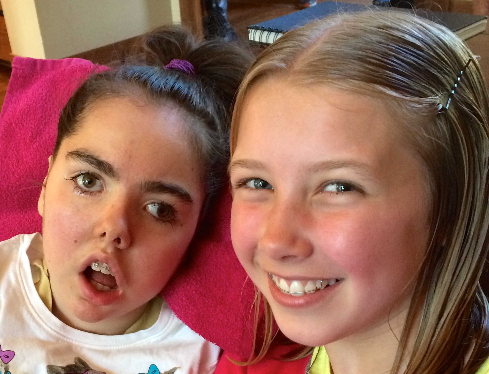 Now Abbie has braces and Claire doesn't! July 2014